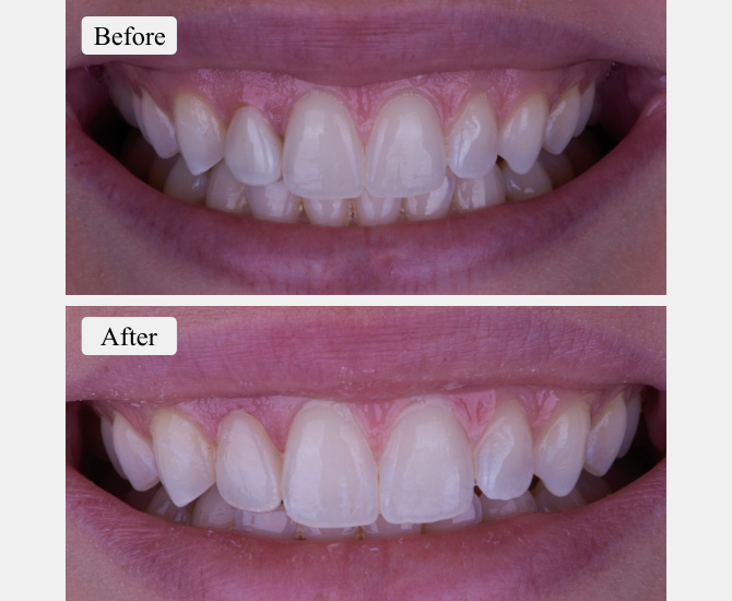 Smile 14